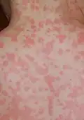 Po osmi hodinách od prvního snímku se skvrnky rozšířily a začaly se spojovat.