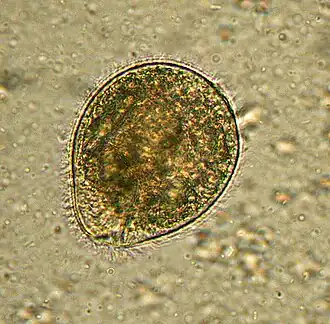 Balantidium coli na vzorku stolice. Organismus je obklopen řasou cilia.