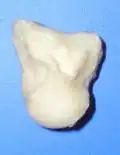 Os capitatum levé ruky, pohled na dorzální stranu