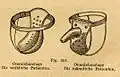Protimasturbační pásy Alberta Molla, 1926.