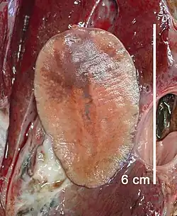 Záběr na světlou motolici Fascioloides magna spolu se zbytky tkáně. Podle vytvořeného měřítka dosahuje délky 6 cm
