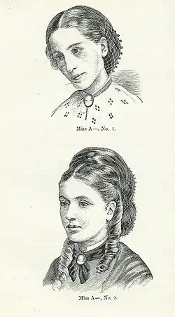 Reprodukce fotografií ženy, která se léčila s mentální anorexií. Jednalo se o pacientku doktora Williama Gulla známou pod názvem Miss A. Horní obrázek je z roku 1866 a zachycuje dobu před léčbou, dolní obrázek z roku 1870 po léčbě.
