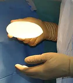 Prsní implantát