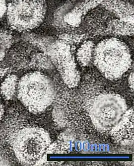 Virus hepatitidy B pod elektronovým mikroskopem