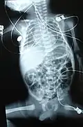 Skiagrafický snímek