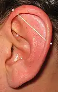 Industrial