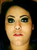 Septum