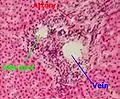 Portobiliární prostor, histologický preparát ve světelném mikroskopu, barveno hematoxylin-eosinem. Označena tepna (červeně), žíla (modře) a žlučovod (zeleně)