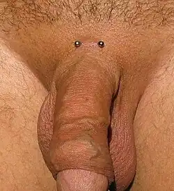 Pubic