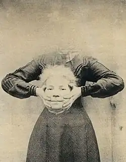 Neznámý autor: Bezhlavá žena, 1900, Anglie