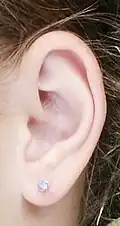 Lobe