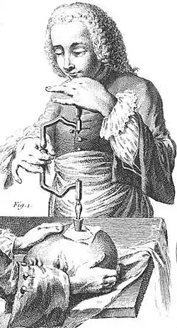 Historické vyobrazení trepanace