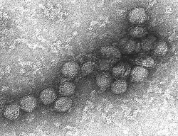 Západonilský virus